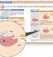 あんしんインプラント に対する画像結果.サイズ: 174 x 185。ソース: www.anshin-implant.jp