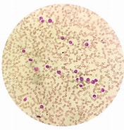 Image result for ESAME del Sangue al Microscopio ottico. Size: 176 x 185. Source: it.freepik.com