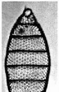 Image result for "eucyrtidium Acuminatum". Size: 120 x 185. Source: www.radiolaria.org