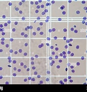 Risultato immagine per ESAME del Sangue al microscopio ottico. Dimensioni: 174 x 185. Fonte: www.alamy.it