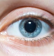 Image result for How Enlarged Can the Eye Pupil Become When an Individual Looks at Somebody They Love?. Size: 178 x 185. Source: www.verywellhealth.com