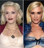 Bildresultat för What Happened To Gwen Stefani's Face. Storlek: 169 x 185. Källa: www.lifeandstylemag.com