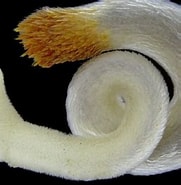 Image result for Chaetoderma Familie. Size: 181 x 185. Source: rajusbiology.com