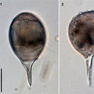 Image result for "Protocystis Thomsoni". Size: 186 x 185. Source: www.shimoda.tsukuba.ac.jp