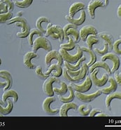 Image result for "pseudochirella Pustulifera". Size: 173 x 185. Source: mcc.nies.go.jp