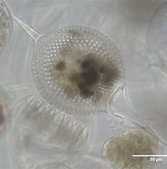 Image result for "Protocystis Harstoni". Size: 183 x 185. Source: plankton.mio.osupytheas.fr