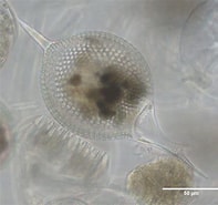 Afbeeldingsresultaten voor "Protocystis Swirei". Grootte: 197 x 185. Bron: plankton.mio.osupytheas.fr