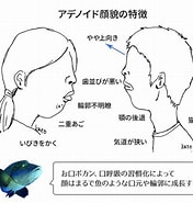 Image result for アデノイド. Size: 176 x 185. Source: www.sadanaga.jp
