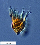 Image result for "strobilidium Typicum". Size: 167 x 185. Source: gallery.obs-vlfr.fr
