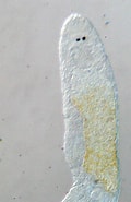 Image result for Dolichomacrostomidae. Size: 120 x 185. Source: artfakta.se