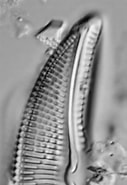 Afbeeldingsresultaten voor "pontoptilus Ovalis". Grootte: 126 x 185. Bron: diatoms.org