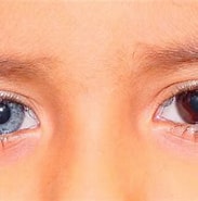 Image result for "heterochromia Papyrifera". Size: 183 x 166. Source: plano.co