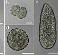 Afbeeldingsresultaten voor "catablema Vesicarium". Grootte: 196 x 185. Bron: www.researchgate.net