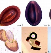 Afbeeldingsresultaten voor "ceratocymba Leuckarti". Grootte: 180 x 185. Bron: www.researchgate.net