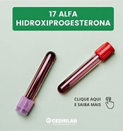 Image result for Alfa hidroxiprogesterona. Size: 174 x 185. Source: cedirlab.com.br