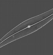 Image result for "pleurogonium Spinosissimum". Size: 177 x 185. Source: www.microbehunter.com