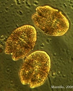 Image result for "gymnodinium Sanguineum". Size: 148 x 185. Source: cfb.unh.edu