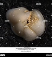 Image result for Globorotalia Brady. Size: 171 x 185. Source: www.alamy.com