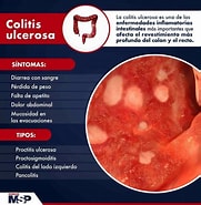 Image result for +colitus. Size: 181 x 185. Source: medicinaysaludpublica.com