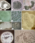 Afbeeldingsresultaten voor "Protocystis Swirei". Grootte: 151 x 185. Bron: www.researchgate.net