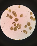 Afbeeldingsresultaten voor "ostreopsis Labens". Grootte: 148 x 185. Bron: www.reef2reef.com