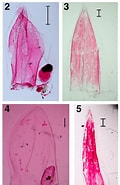 Afbeeldingsresultaten voor "lensia Hardy". Grootte: 120 x 185. Bron: www.researchgate.net