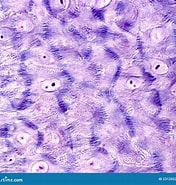 Afbeeldingsresultaten voor Dendrotion spinosum Stam. Grootte: 176 x 185. Bron: www.dreamstime.com