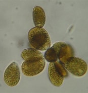 Image result for "ostreopsis Ovata". Size: 174 x 185. Source: culturamarinara.com