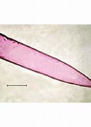 Image result for "Xystonellopsis Sp.". Size: 133 x 185. Source: www.researchgate.net