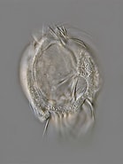 Afbeeldingsresultaten voor "uronychia Transfuga". Grootte: 139 x 185. Bron: www.mikroskopie-forum.de