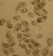 Image result for "plagiopyla Nasuta". Size: 176 x 185. Source: www.flickr.com