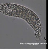 Afbeeldingsresultaten voor "trachelostyla Pediculiformis". Grootte: 183 x 185. Bron: www.youtube.com
