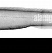 Image result for "simenchelys Parasitica". Size: 180 x 84. Source: www.alamy.com