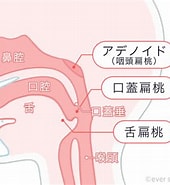 Image result for アデノイド肥大症. Size: 170 x 185. Source: kawagoe-family.clinic