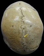Bildergebnis für Foramina parietalia magna. Größe: 146 x 185. Quelle: ar.inspiredpencil.com
