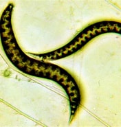 Image result for "procerastea Nematodes". Size: 176 x 185. Source: biologandocombrunaepamela.blogspot.com