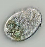 Image result for "plagiopyla Nasuta". Size: 176 x 185. Source: www.plingfactory.de