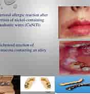 in vitro Models For Biocompatibility of Dental Materials માટે ઇમેજ પરિણામ. માપ: 176 x 185. સ્ત્રોત: www.slideshare.net