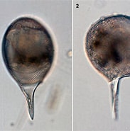 Image result for "Protocystis Harstoni". Size: 183 x 185. Source: www.biol.tsukuba.ac.jp