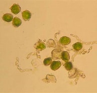 Image result for "cladococcus Megaceros". Size: 193 x 185. Source: www.canbr.gov.au