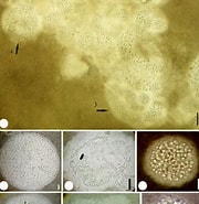 Image result for "protocystis Harstoni". Size: 180 x 185. Source: www.researchgate.net