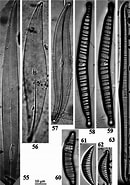 Image result for "plegmosphaera Pachyplegma". Size: 130 x 185. Source: www.researchgate.net