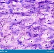 Image result for Dendrotion spinosum Stam. Size: 187 x 185. Source: www.dreamstime.com