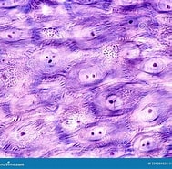 Afbeeldingsresultaten voor Dendrotion spinosum Stam. Grootte: 189 x 185. Bron: www.dreamstime.com