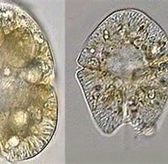 Image result for "gymnodinium Sanguineum". Size: 190 x 150. Source: www.smhi.se