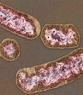 Image result for "pruvotella Pellucida". Size: 163 x 185. Source: microbiomology.org