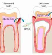 Dental Pulp Stem Cell Treatment ಗಾಗಿ ಇಮೇಜ್ ಫಲಿತಾಂಶ. ಗಾತ್ರ: 176 x 185. ಮೂಲ: www.mdpi.com