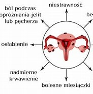 Image result for Endometrioza Wewnętrzna. Size: 183 x 160. Source: klinikaotco.pl