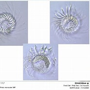Image result for "strobilidium Typicum". Size: 185 x 185. Source: www.photomacrography.net