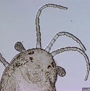 Image result for "nerilla Antennata". Size: 183 x 185. Source: handwiki.org